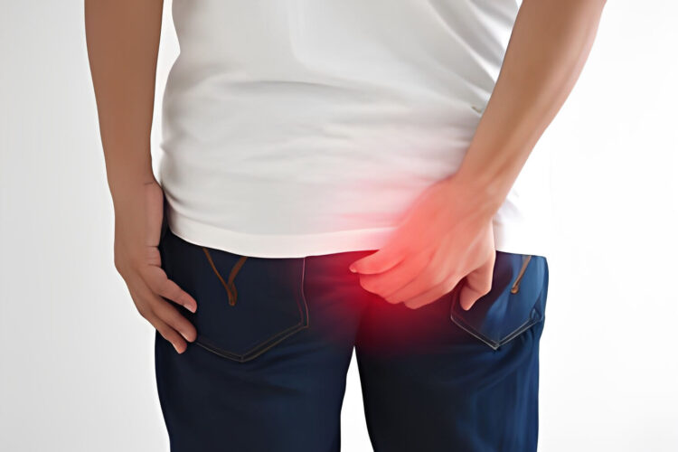 anal fissure treatment in dubai