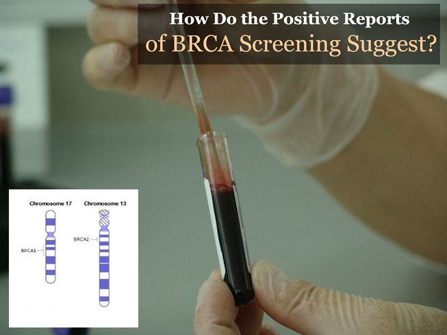 breast cancer screening in dubai
