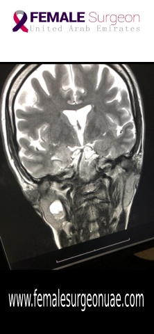 Parotid Tumor detected by Dr. Humaa Darr!!!