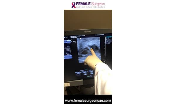 Placement of Breast Clip by Dr. Naglaa- Interventional Breast Radiologist With Dr. Humaa Darr at Al Zahra Hospital in Dubai. 7 Placement of Breast Clip by Dr. Naglaa