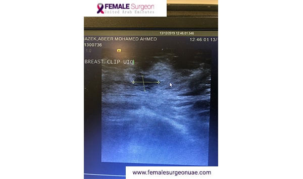 Breast Center