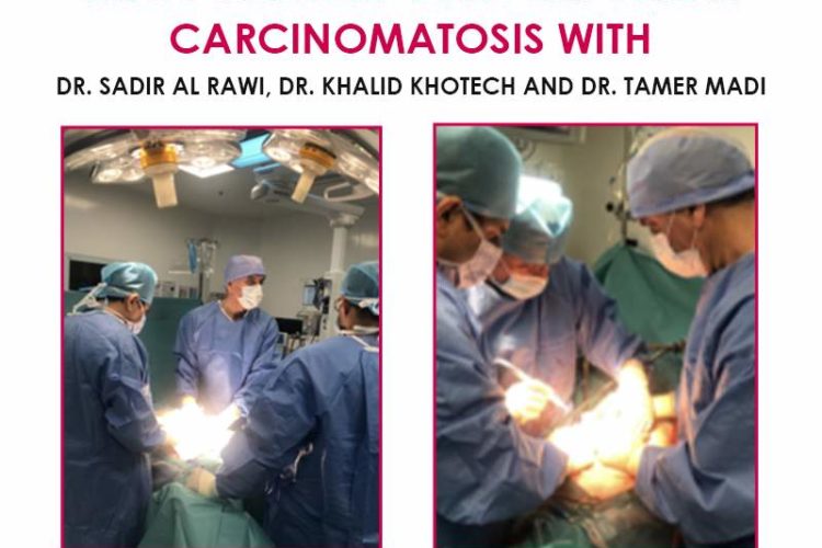 HIPEC surgery for peritoneal carcinomatosis with Dr. Sadir Al Rawi, Dr. Khalid Khotech, and Dr. Tamer Madi.