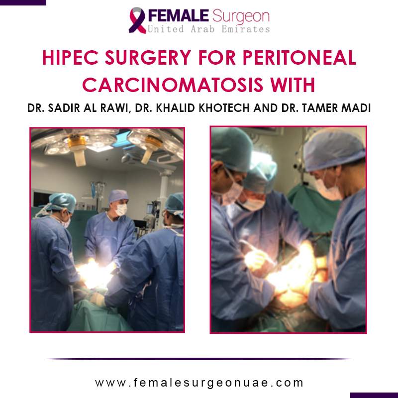 HIPEC surgery for peritoneal carcinomatosis with Dr. Sadir Al Rawi, Dr. Khalid Khotech, and Dr. Tamer Madi.