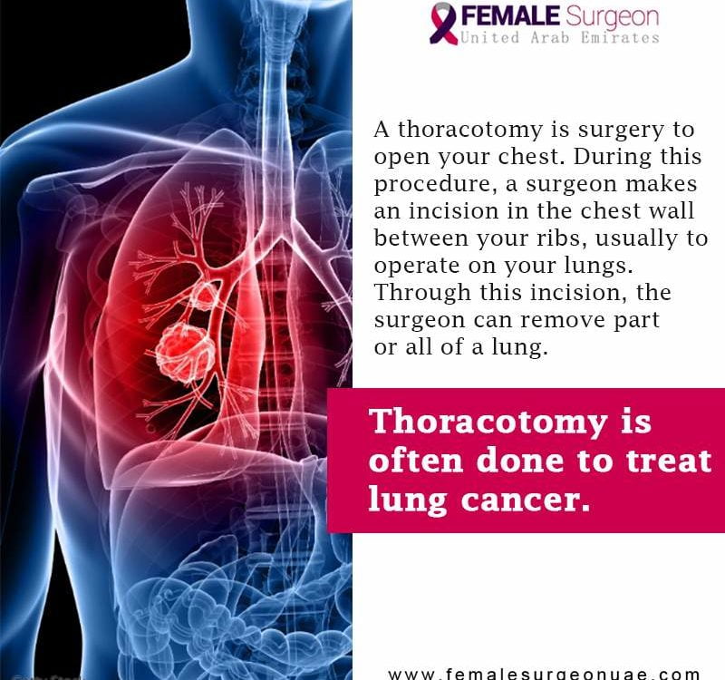 What is Thoracotomy?